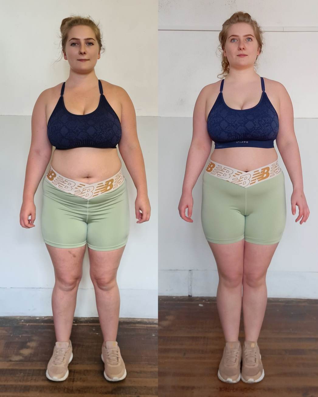 Front-view before and after of a female client