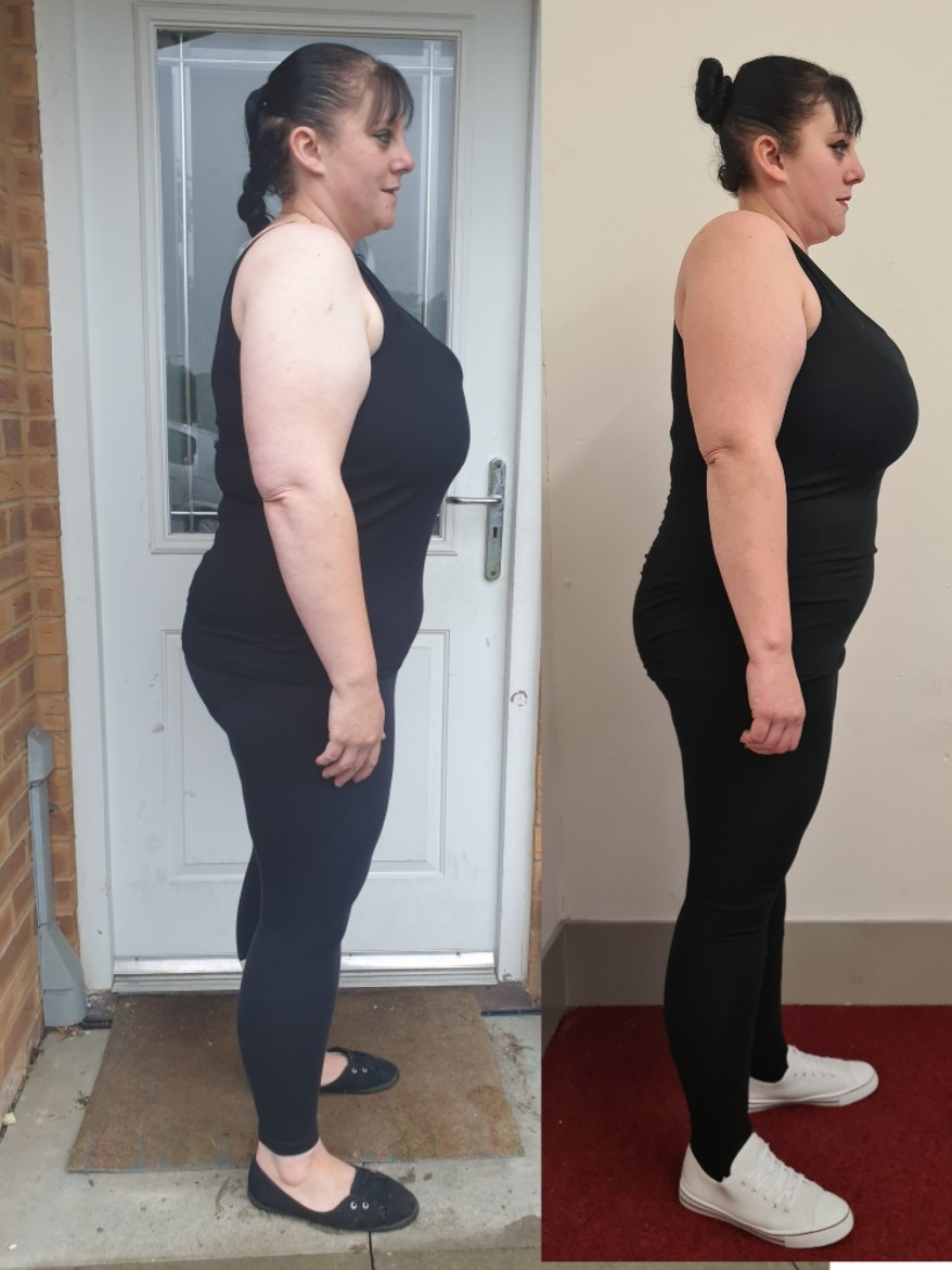 Side-view before and after of a female client