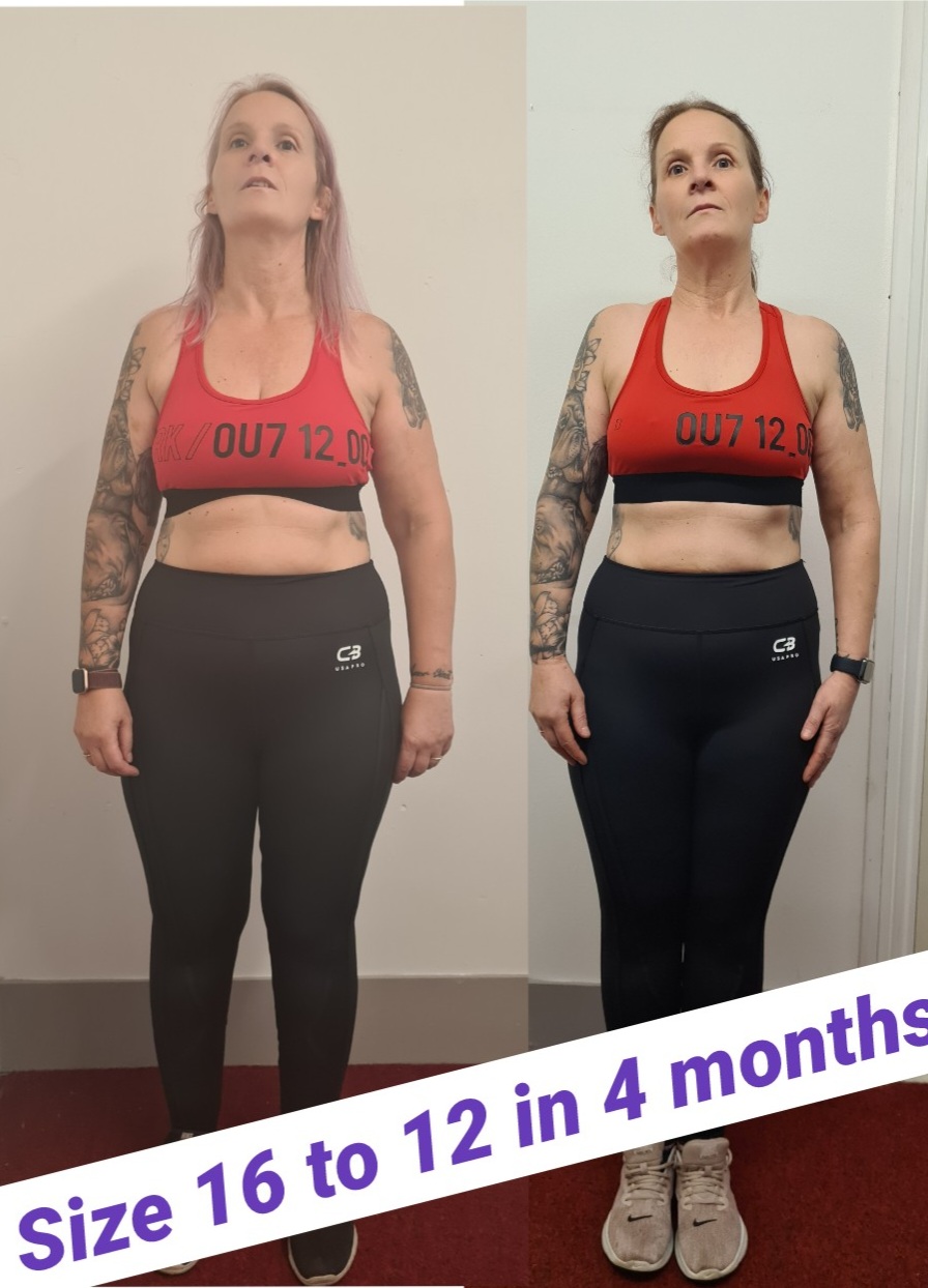 Front-view before and after of a female client